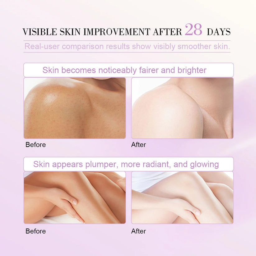 MOIST Niacinamide & Glutathione Body Lotion 8x Skin Whitening