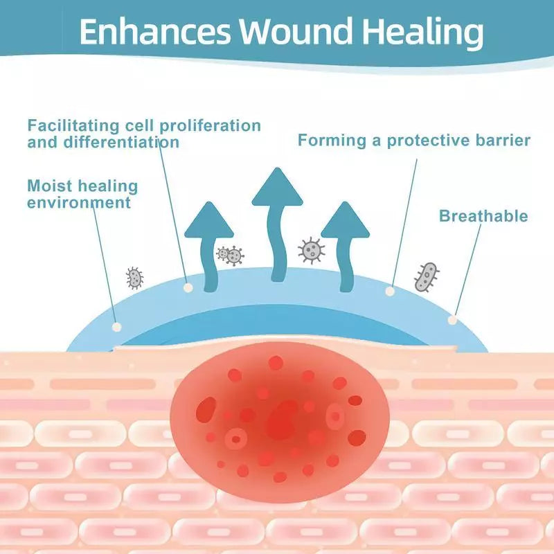 Hydrocolloid Patch Bandages Roll – For Acne, Pimples & Scar Care