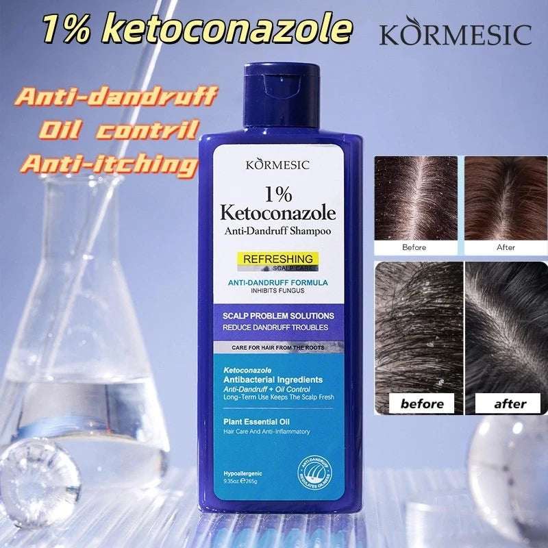 KORMESIC Anti-Dandruff Ketoconazole Shampoo for Scalp Treatment and Oil Control