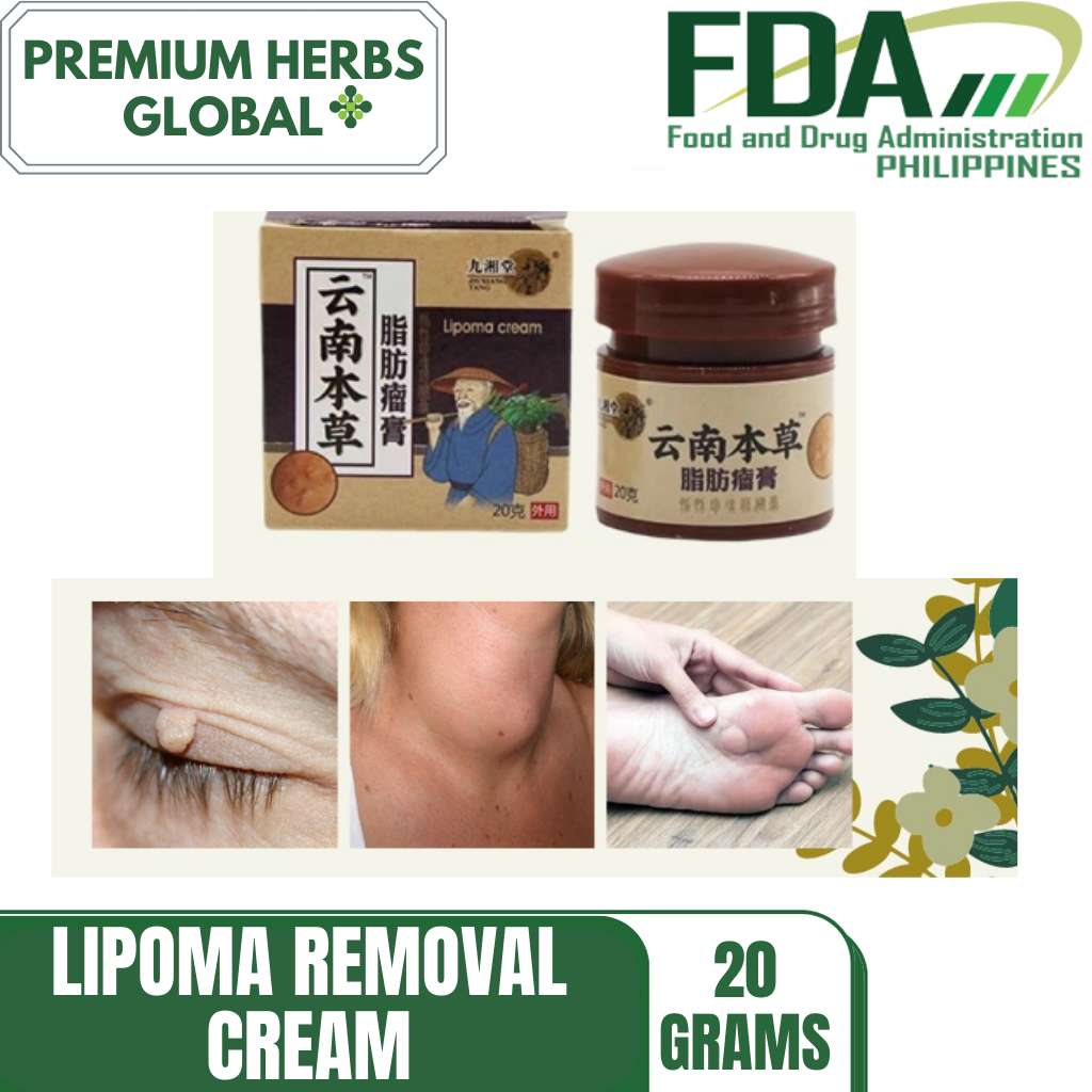 20g Lipoma Removal Cream