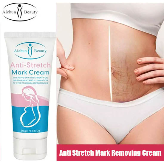 Anti-Stretch Mark Cream