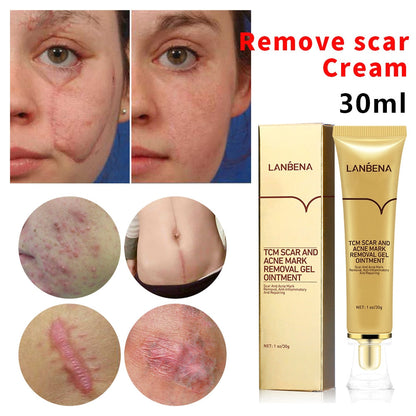 LANBENA TCM Scar & Acne Mark Removal Gel Ointment