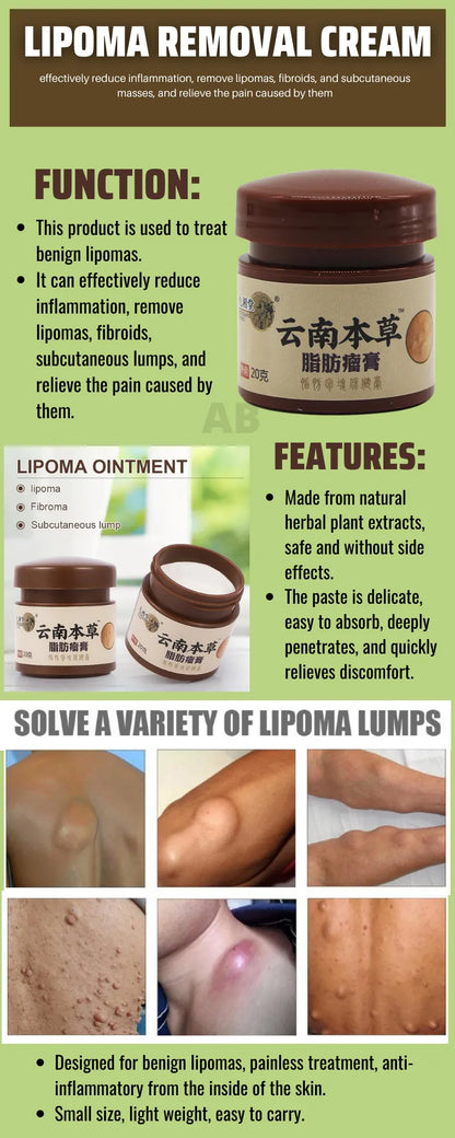 20g Lipoma Removal Cream